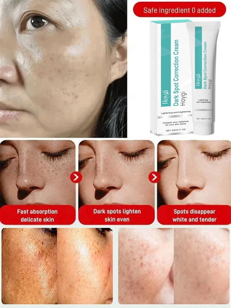 강력한 스팟 제거 화이트닝 크림 피부를 밝게 빠르게 멜 - Luxury Skincare Brands 리뷰 및 가격