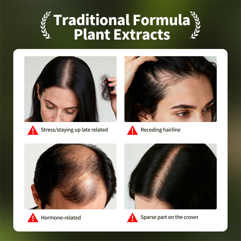 자연 모발 성장 세트 우스만 허브 샴푸 비누 허브 모발 - Epidermal Growth Factor 리뷰 및 가격