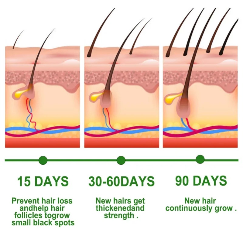 모발 성장 세럼 빠르게 성장하는 헤어 케어 세트 에센셜 - Epidermal Growth Factor 리뷰 및 가격