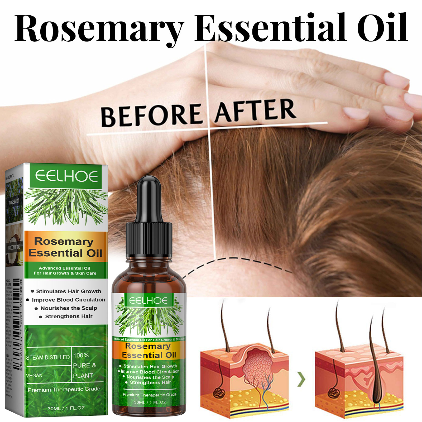 모발 성장 세럼 빠르게 성장하는 헤어 케어 세트 에센셜 - Epidermal Growth Factor 리뷰 및 가격