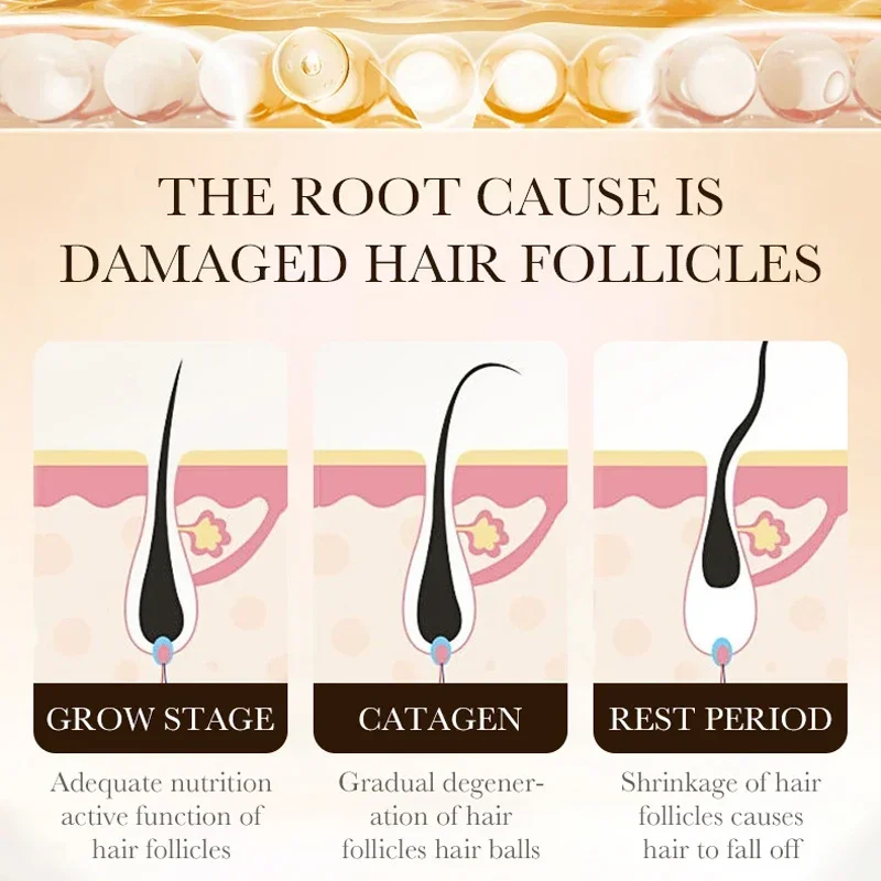비오틴 빠른 모발 성장 오일 제품 케어 두피 마사지 트 - Epidermal Growth Factor 리뷰 및 가격