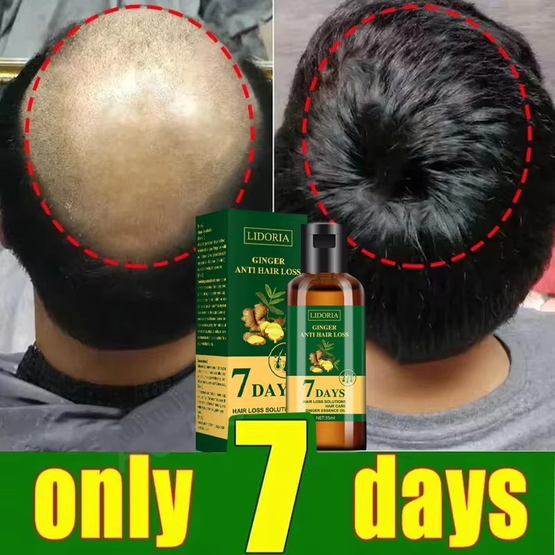 헤어 성장 세럼 7일 빠른 재성장 에센셜 캡슐 탈모 방 - Epidermal Growth Factor 리뷰 및 가격