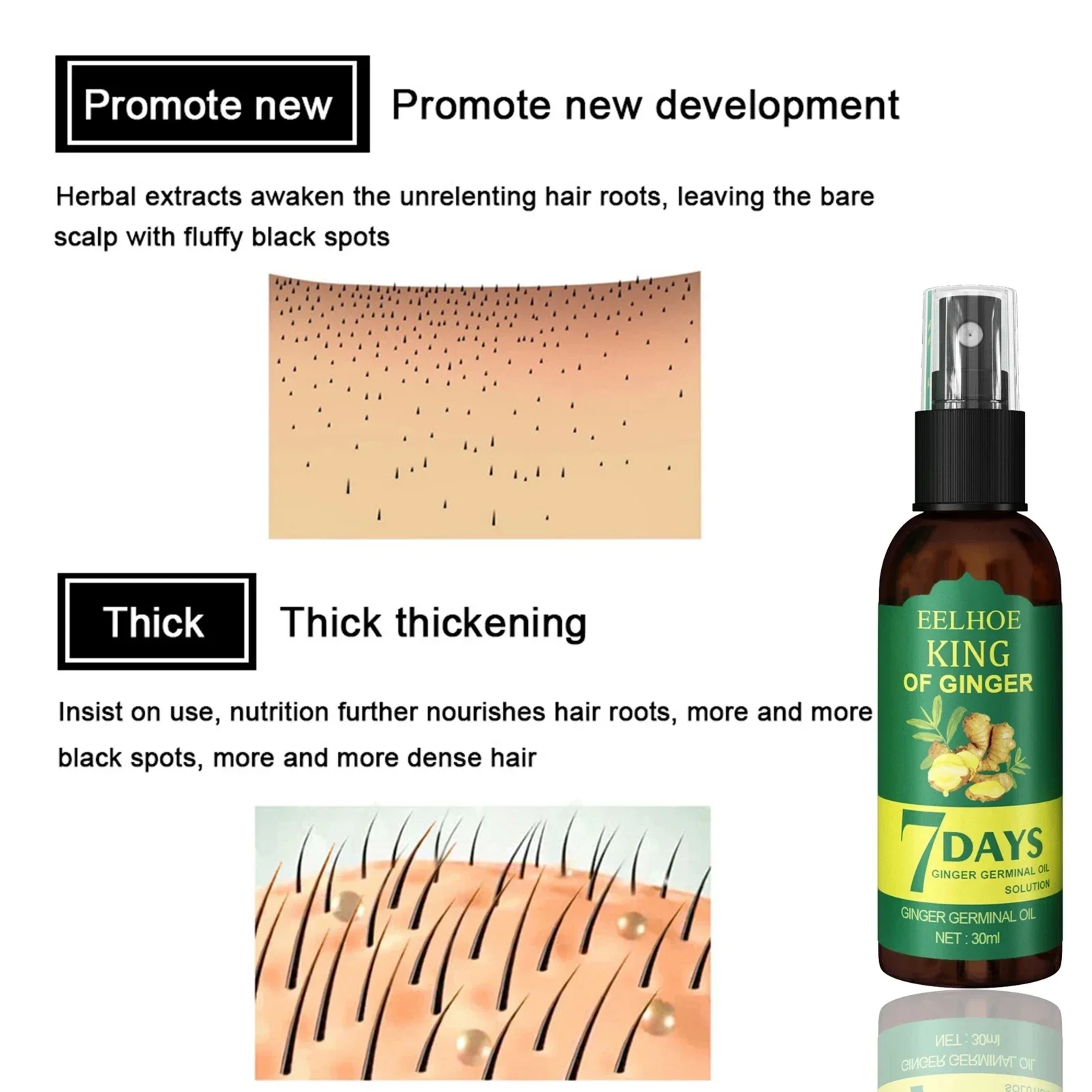 2024 생강 모발 성장 세럼 분무기, 모발 재성장,  - Epidermal Growth Factor 리뷰 및 가격