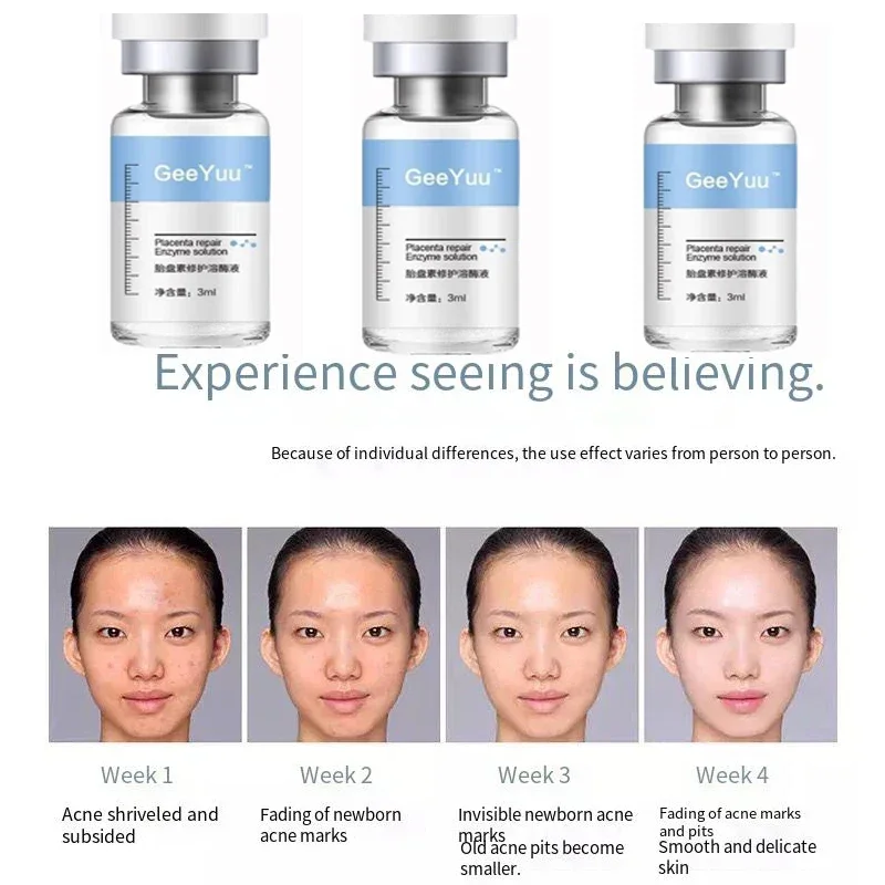 폴리펩티드 태반 동결 건조 파우더 에센스 리페어 페이셜 - Epidermal Growth Factor 리뷰 및 가격